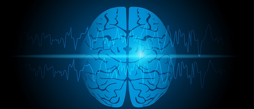 Illustration of human brain with focal seizure showing abnormal sharp wave on electroencephalography or EEG.