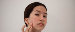 Cropped shot of a young woman squeezing a pimple on her face