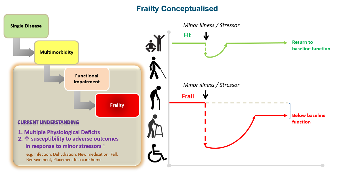 Webinar write-up: Maintaining muscle strength to reduce falls risk