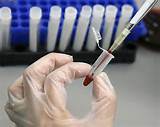doctor conducting a blood test