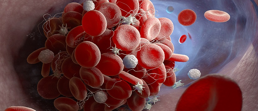 Abstract image of a blood clot