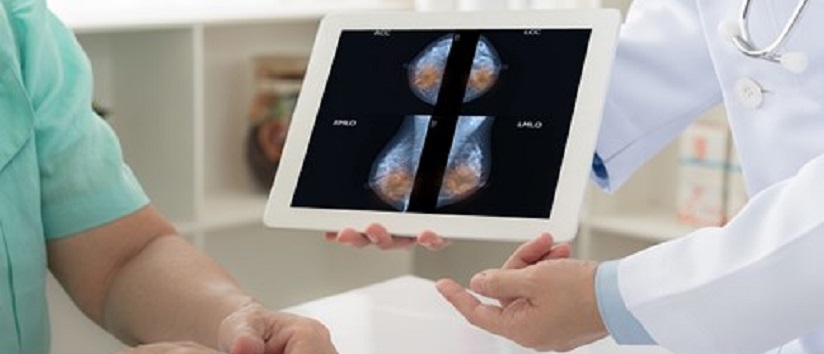 breast scan, breast cancer