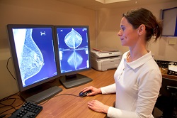 Breast screening computer