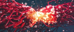 cancer cell and Neoplastic change