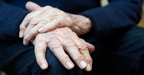 Parkinson's disease, hands