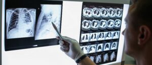 lung scan, COPD