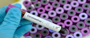 coronavirus test