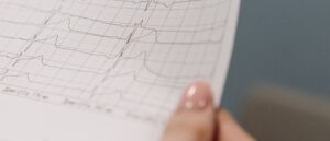 A electrocardiogram
