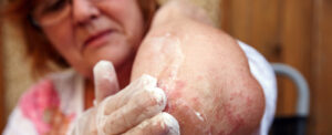 skin conditions