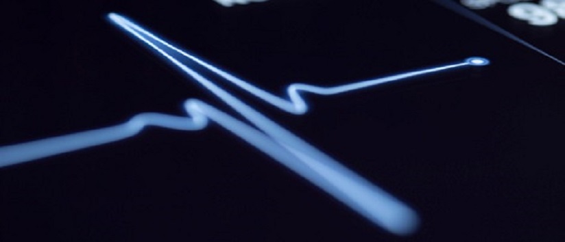 Abstract image of a heart beat, ECG, AF
