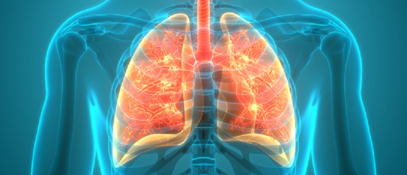 Abstract image showing lung cancer, lung disease, pulmonary embolism