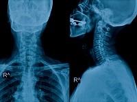 Neck and skull x-ray