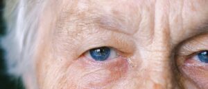 floaters and flashes in eye