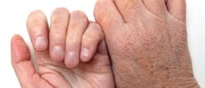 ageing skin, rashes, skin conditions in the elderly