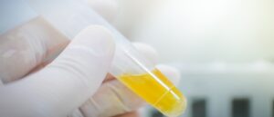 urine test
