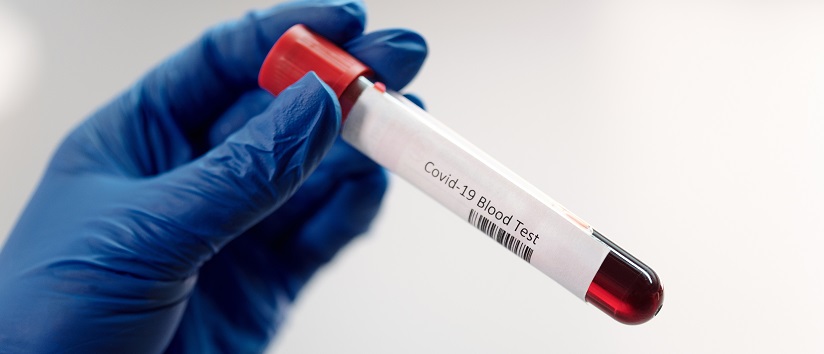 Doctor holding vile of blood labelled 'Covid-19 blood test', test for Long Covid