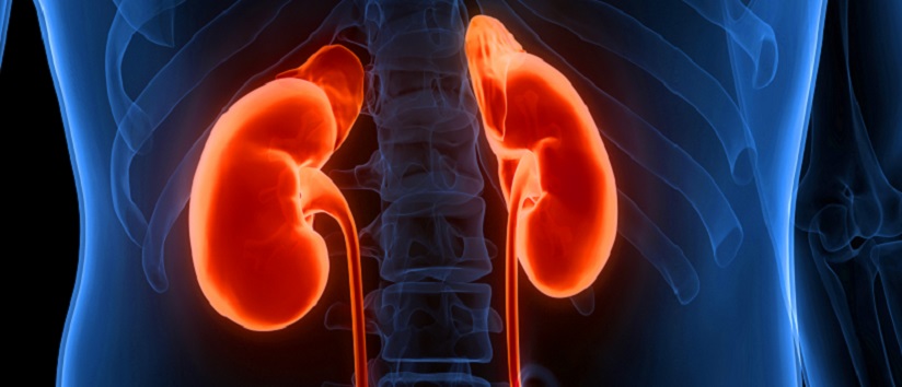 kidneys, Renal artery stenosis (RAS)