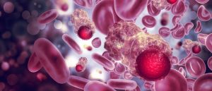 blood cancer