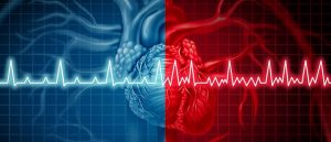 Atrial fibrillation and normal or abnormal heart rate rythm concept as a cardiac disorder as a human organ with healthy and unhealthy ecg monitoring in a 3D illustration style, cardiology, ESC