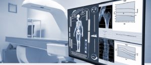Fracture services and bisphosphonates