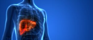 Liver disease, PBC