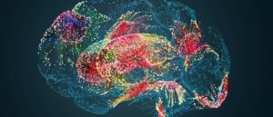 Alzheimer's disease brain