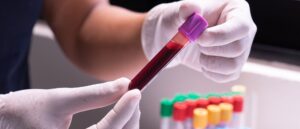 blood test