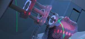 Man Receiving Radiotherapy (Radiation Therapy) for Cancer Treatment
