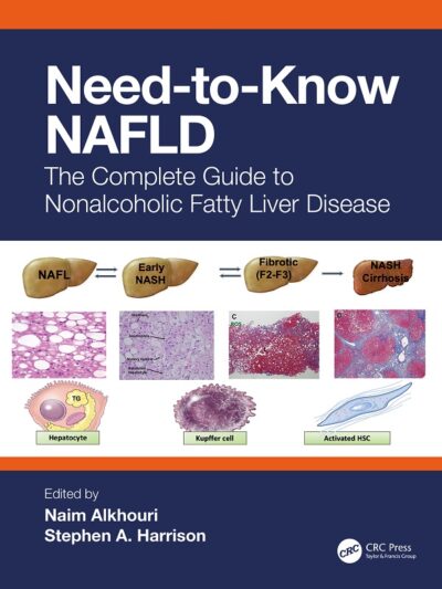 The Complete Guide to Nonalcoholic Fatty Liver Disease